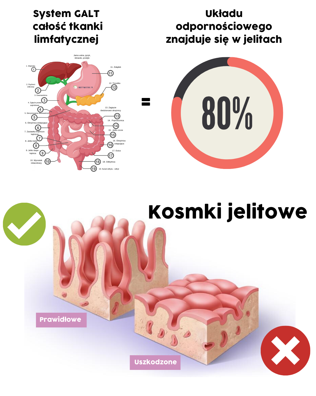 Wszystko co musisz wiedzieć na temat "Nieszczelnych jelit"