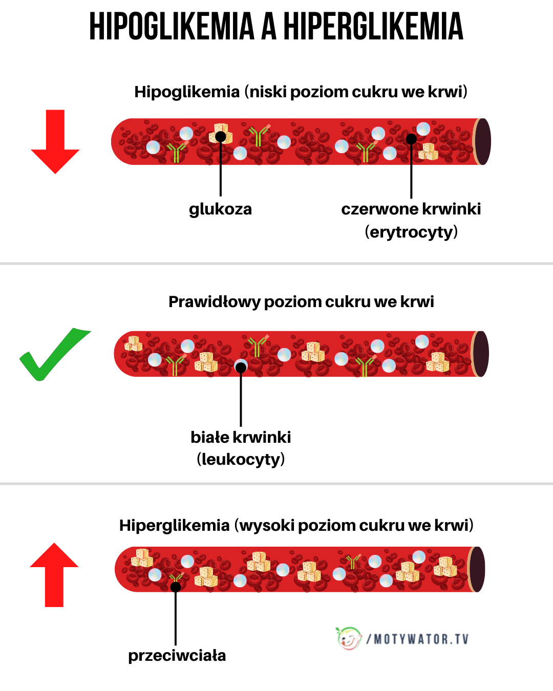 Hipoglikemia a hiperglikemia