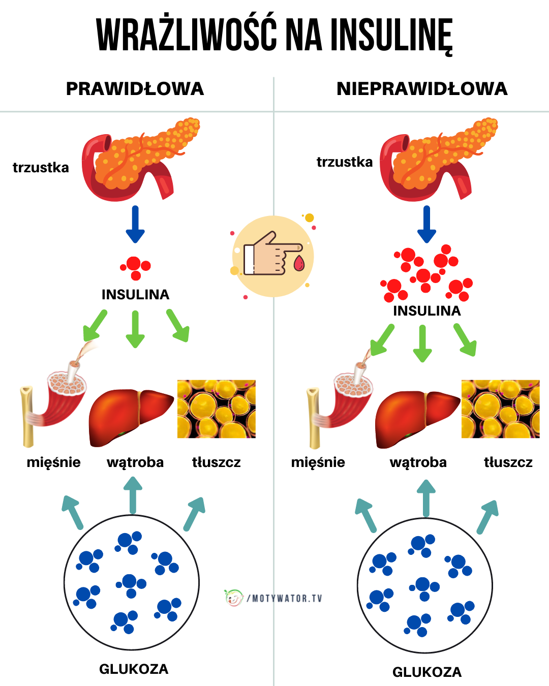 Wrażliwość na insulinę