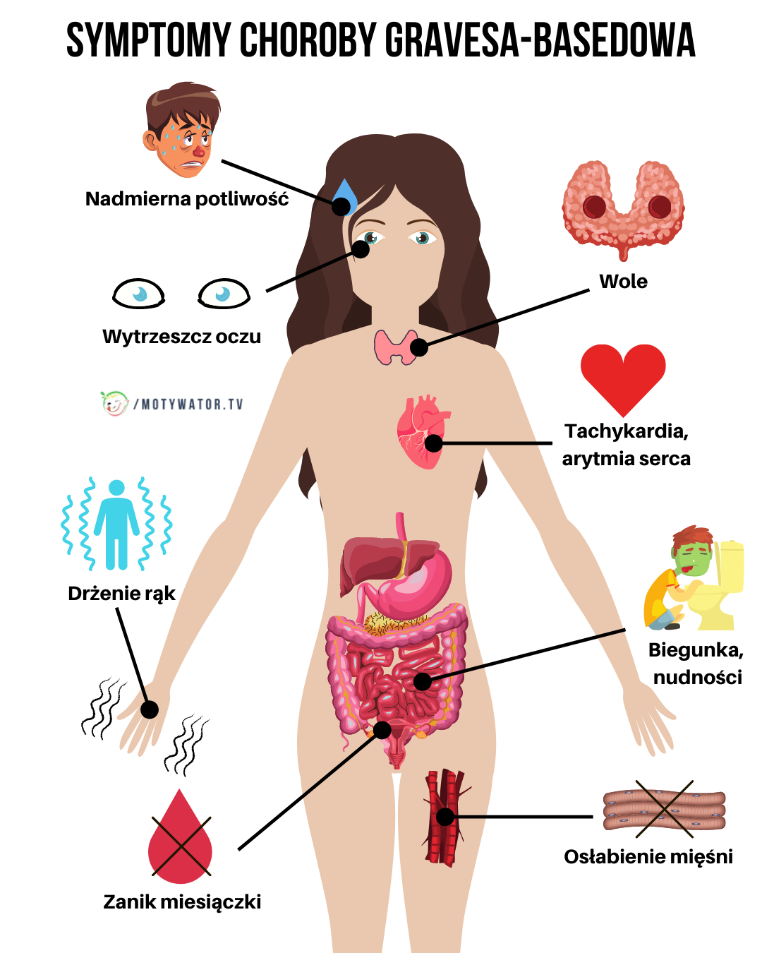 Symptomy choroby gravesa-basedowa