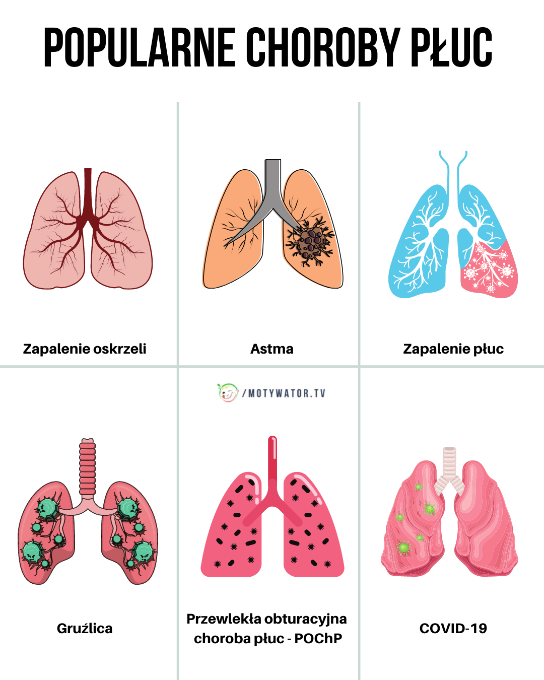 Popularne choroby płuc